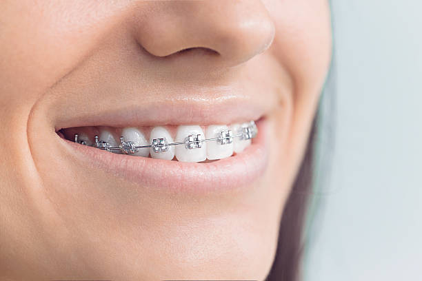 Best Invisalign and Clear Aligners  in Curwensville, PA